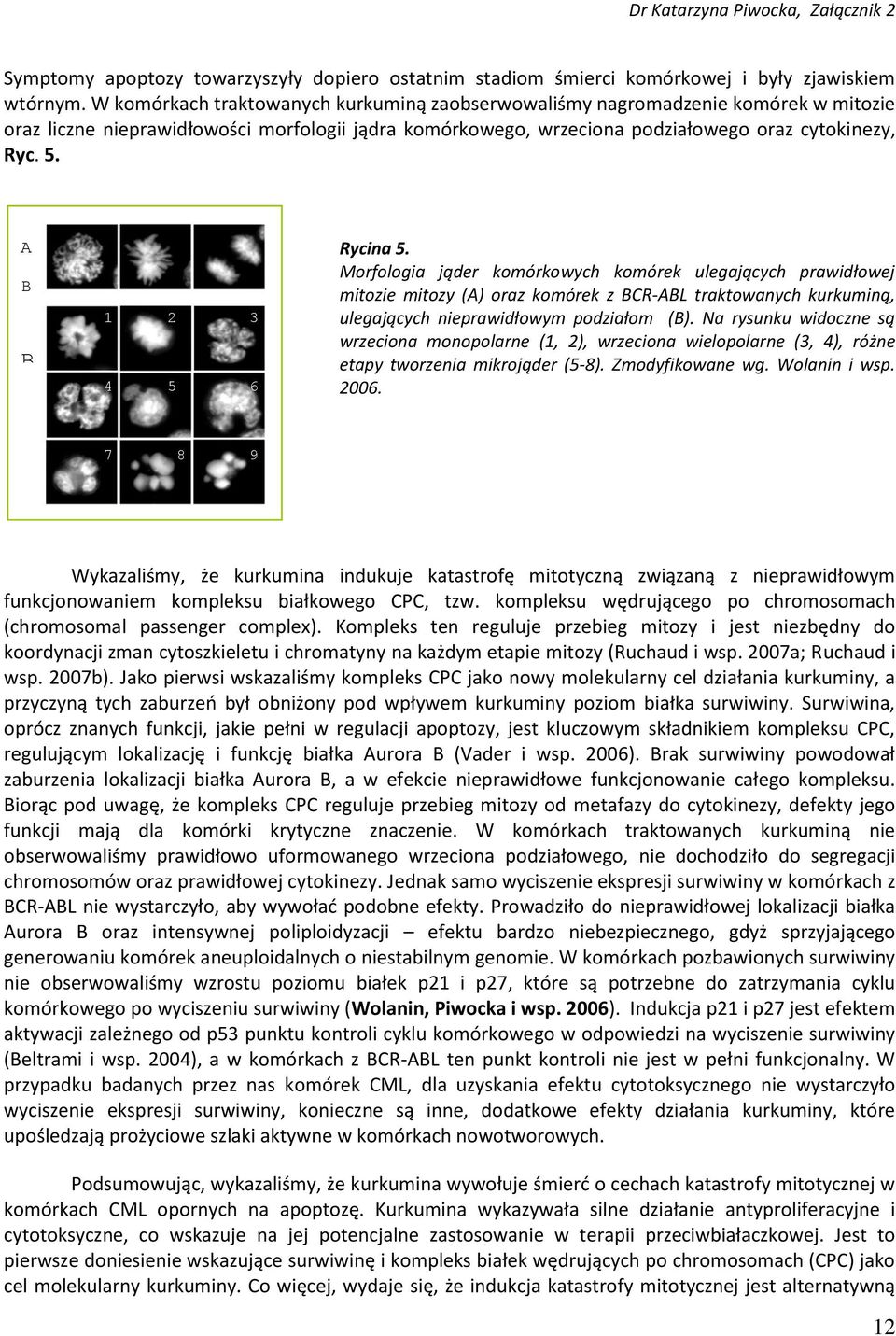 A B B 1 2 3 4 5 6 Rycina 5. Morfologia jąder komórkowych komórek ulegających prawidłowej mitozie mitozy (A) oraz komórek z BCR-ABL traktowanych kurkuminą, ulegających nieprawidłowym podziałom (B).