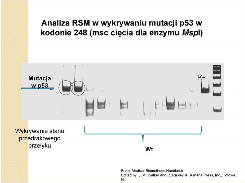 przedrakowego przełyku Wt From: Medical Biomethods Handbook