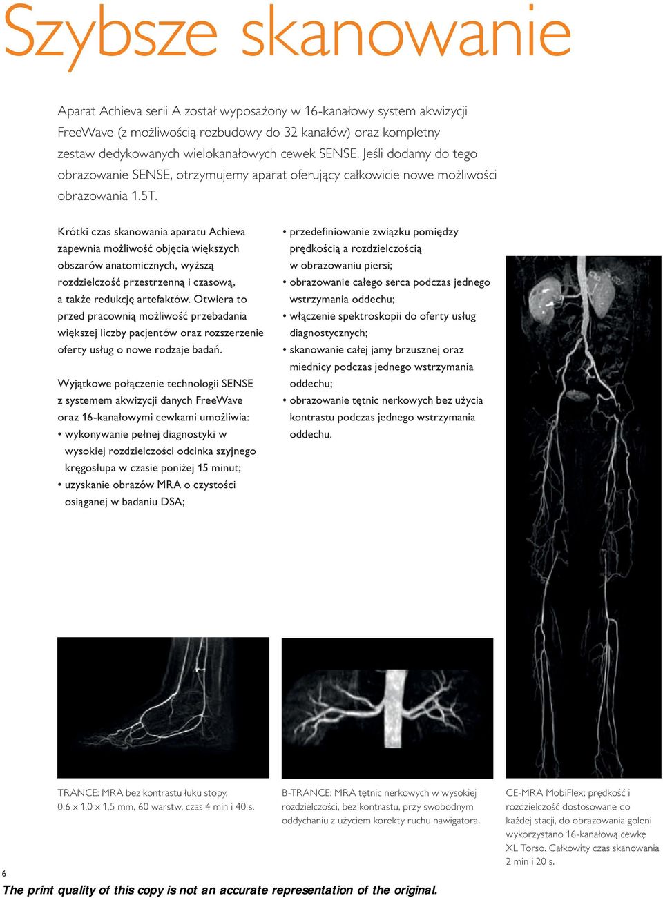 Krótki czas skanowania aparatu Achieva zapewnia możliwość objęcia większych obszarów anatomicznych, wyższą rozdzielczość przestrzenną i czasową, a także redukcję artefaktów.