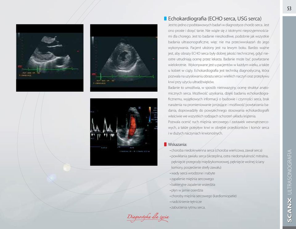 Bardzo ważne jest, aby obrazy ECHO serca były dobrej jakości technicznej, gdyż nieostre utrudniają ocenę przez lekarza. Badanie może być powtarzane wielokrotnie.