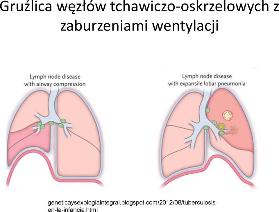 zaburzeniami wentylacji