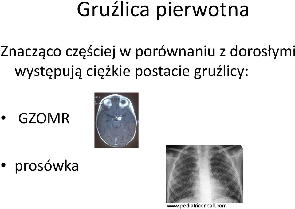 występują ciężkie postacie