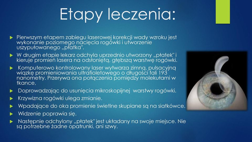 Komputerowo kontrolowany laser wytwarza zimną, pulsacyjną wiązkę promieniowania ultrafioletowego o długości fali 193 nanometry.