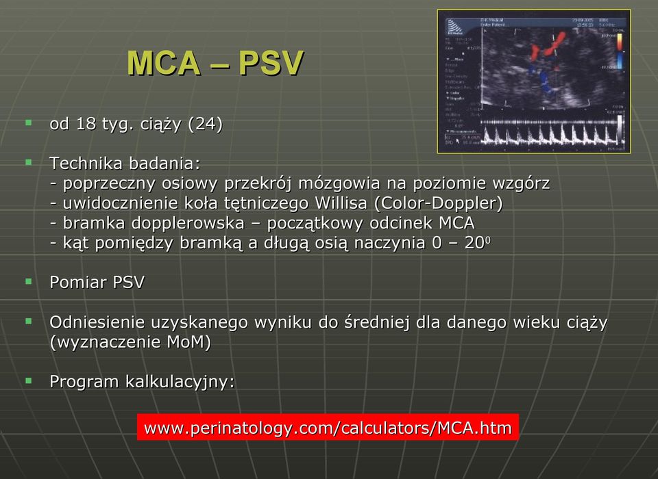 koła tętniczego Willisa (Color-Doppler) - bramka dopplerowska początkowy odcinek MCA - kąt pomiędzy