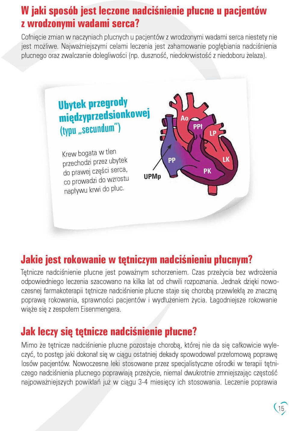 Ubytek przegrody międzyprzedsionkowej (typu secundum ) Ao PPł LP Krew bogata w tlen przechodzi przez ubytek do prawej części serca, co prowadzi do wzrostu napływu krwi do płuc.