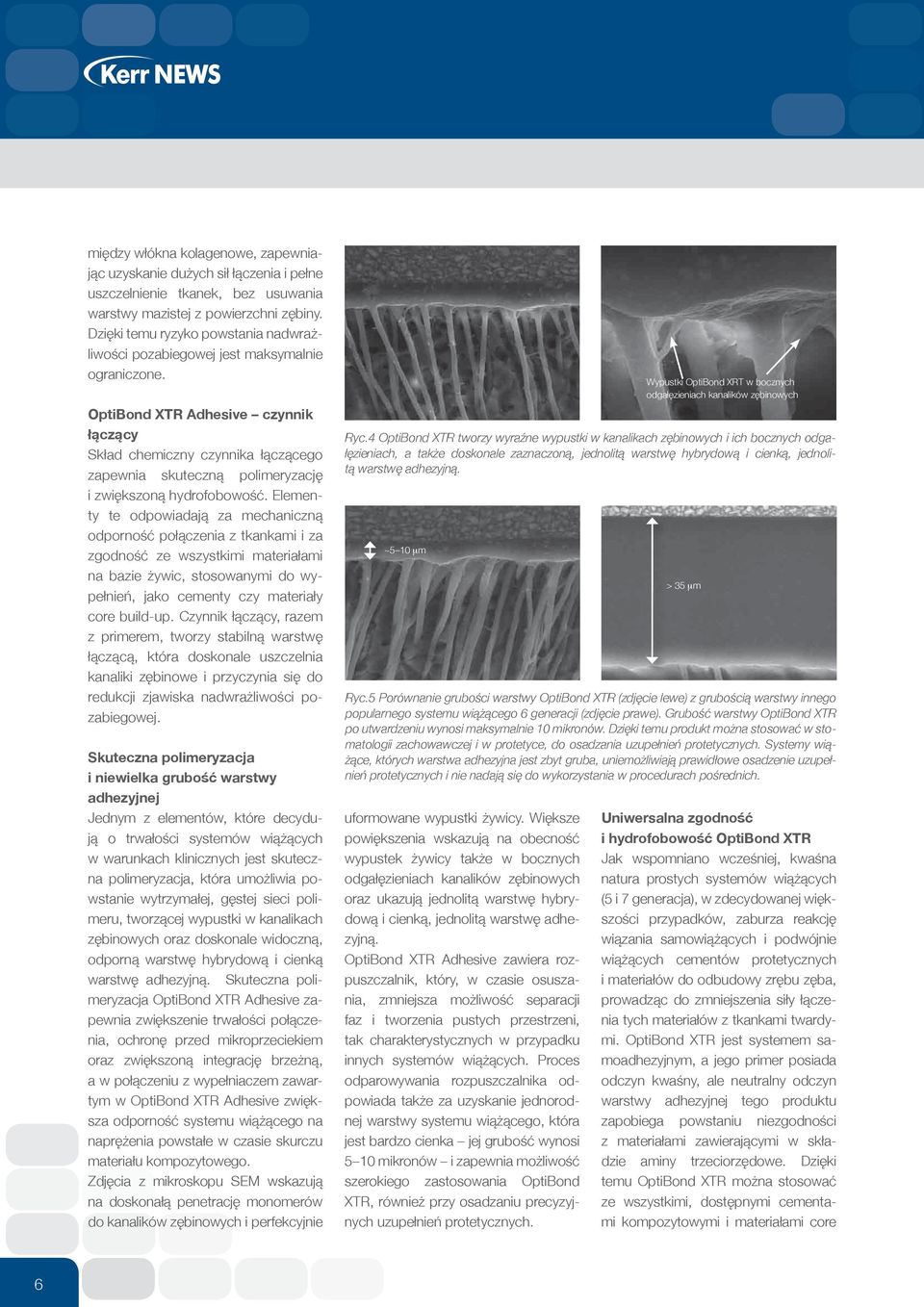 OptiBond XTR Adhesive czynnik łączący Skład chemiczny czynnika łączącego zapewnia skuteczną polimeryzację i zwiększoną hydrofobowość.