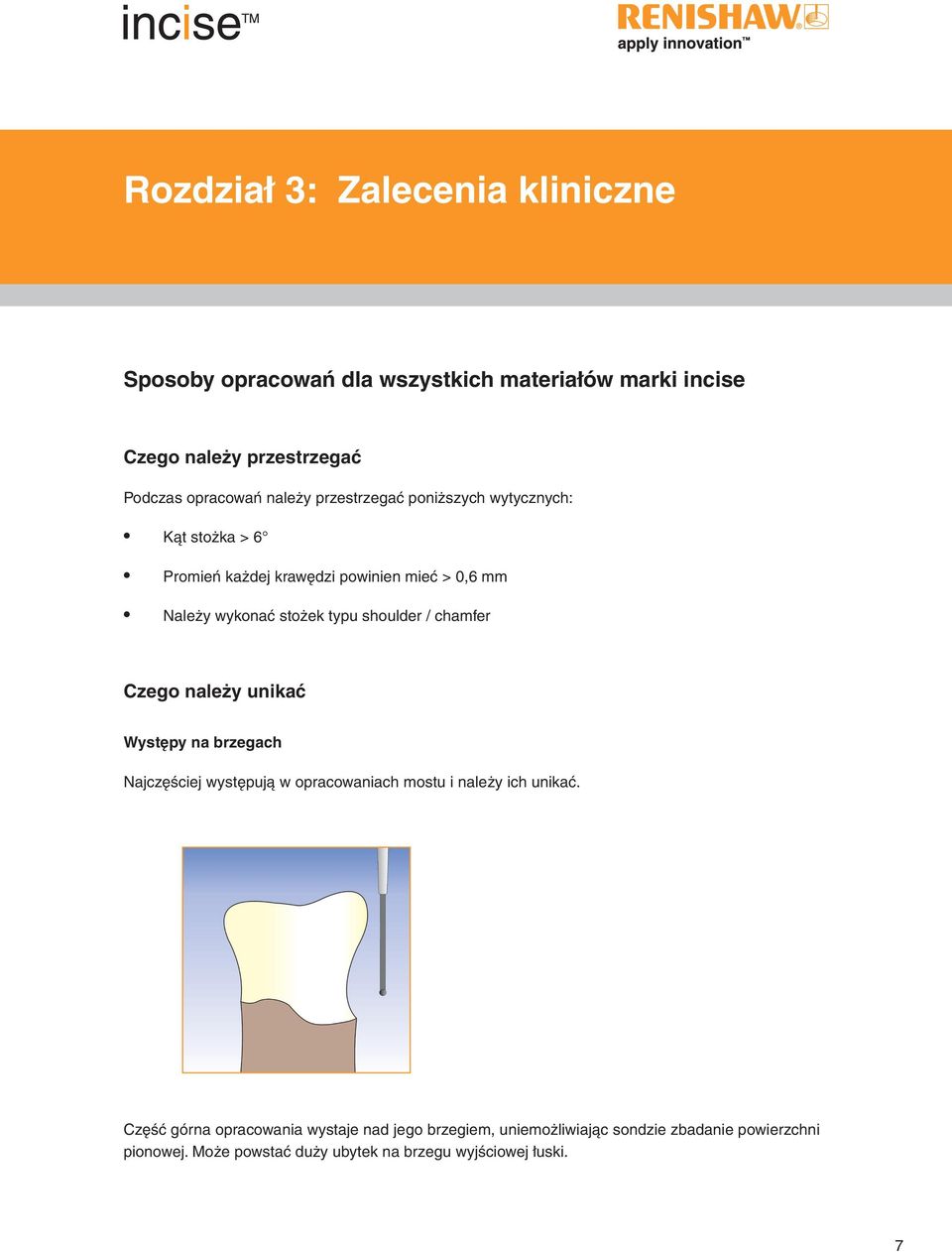 shoulder / chamfer Czego należy unikać Występy na brzegach Najczęściej występują w opracowaniach mostu i należy ich unikać.