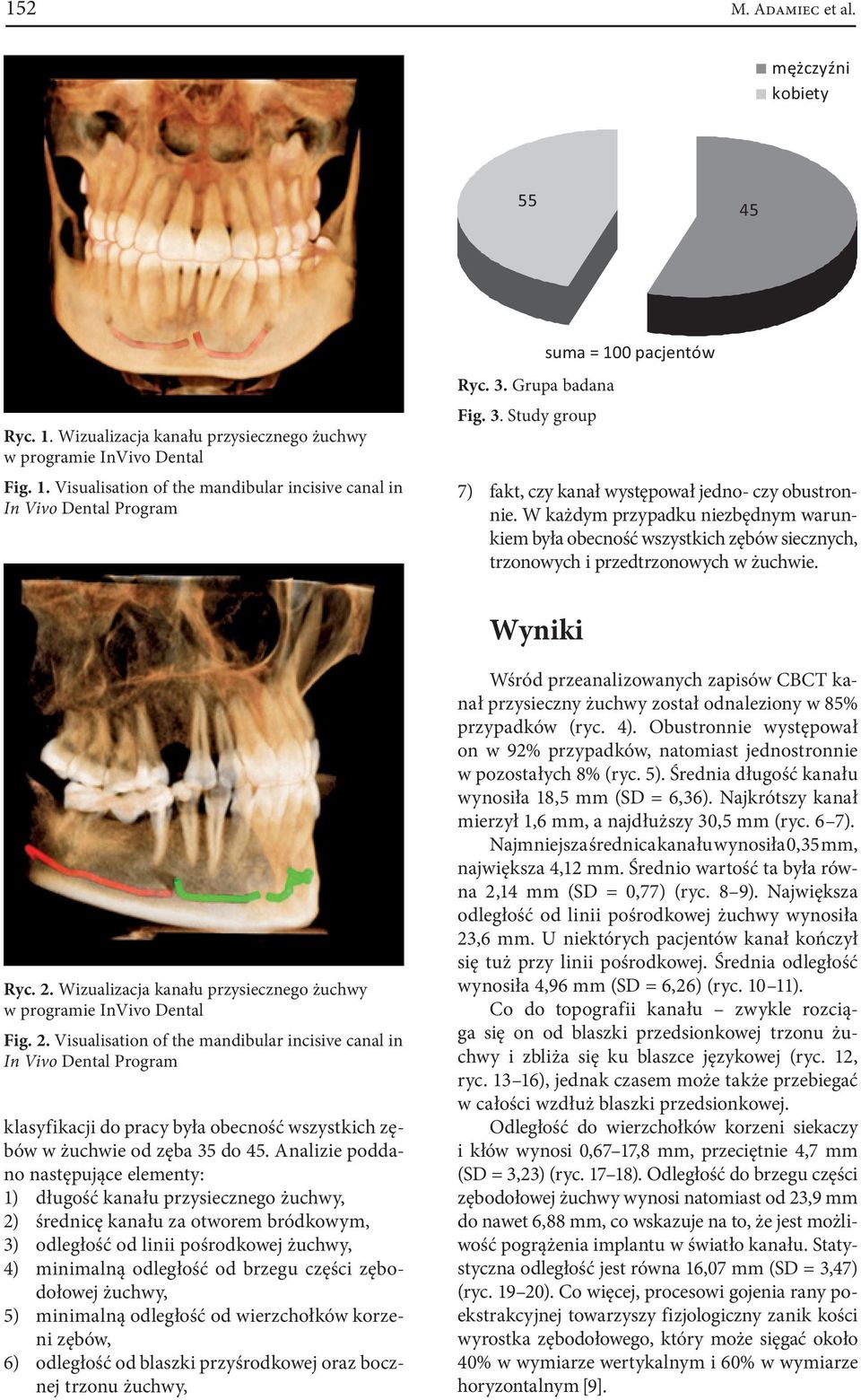W każdym przypadku niezbędnym warunkiem była obecność wszystkich zębów siecznych, trzonowych i przedtrzonowych w żuchwie. Wyniki Ryc. 2.