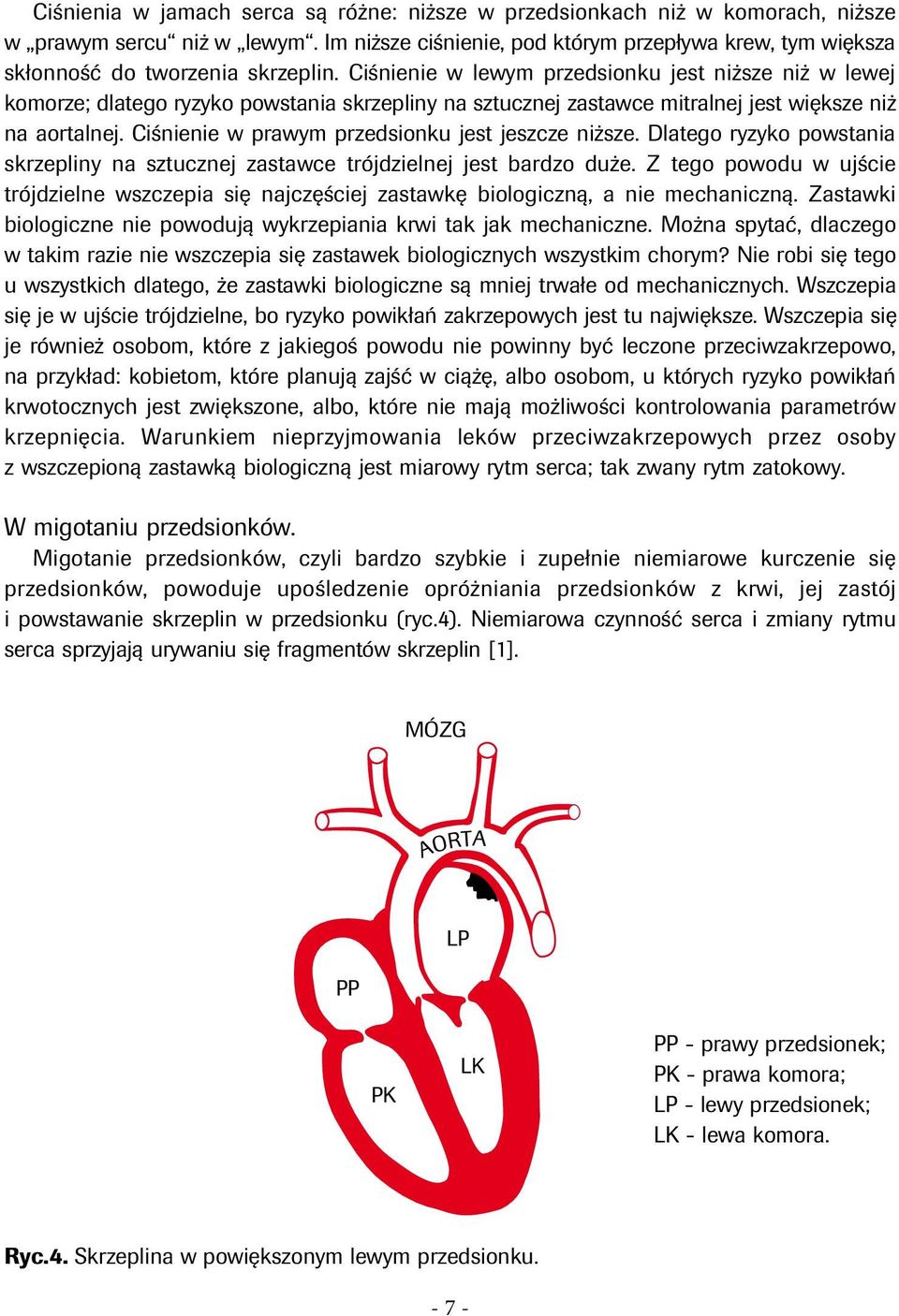 Ciśnienie w lewym przedsionku jest niższe niż w lewej komorze; dlatego ryzyko powstania skrzepliny na sztucznej zastawce mitralnej jest większe niż na aortalnej.