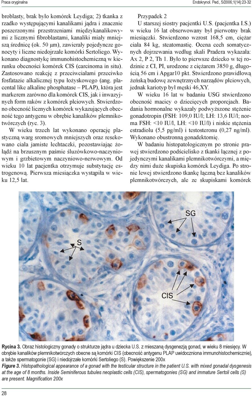 Wykonano diagnostykę immunohistochemiczną w kierunku obecności komórek CIS (carcinoma in situ). Zastosowano reakcję z przeciwciałami przeciwko fosfatazie alkalicznej typu łożyskowego (ang.