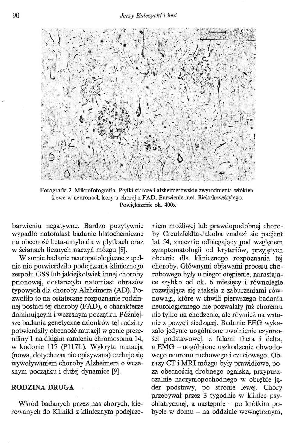 W sumie badanie neuropatologiczne zupełnie nie potwierdziło podejrzenia klinicznego zespołu GSS lub jakiejkolwiek innej choroby prionowej, dostarczyło natomiast obrazów typowych dla choroby