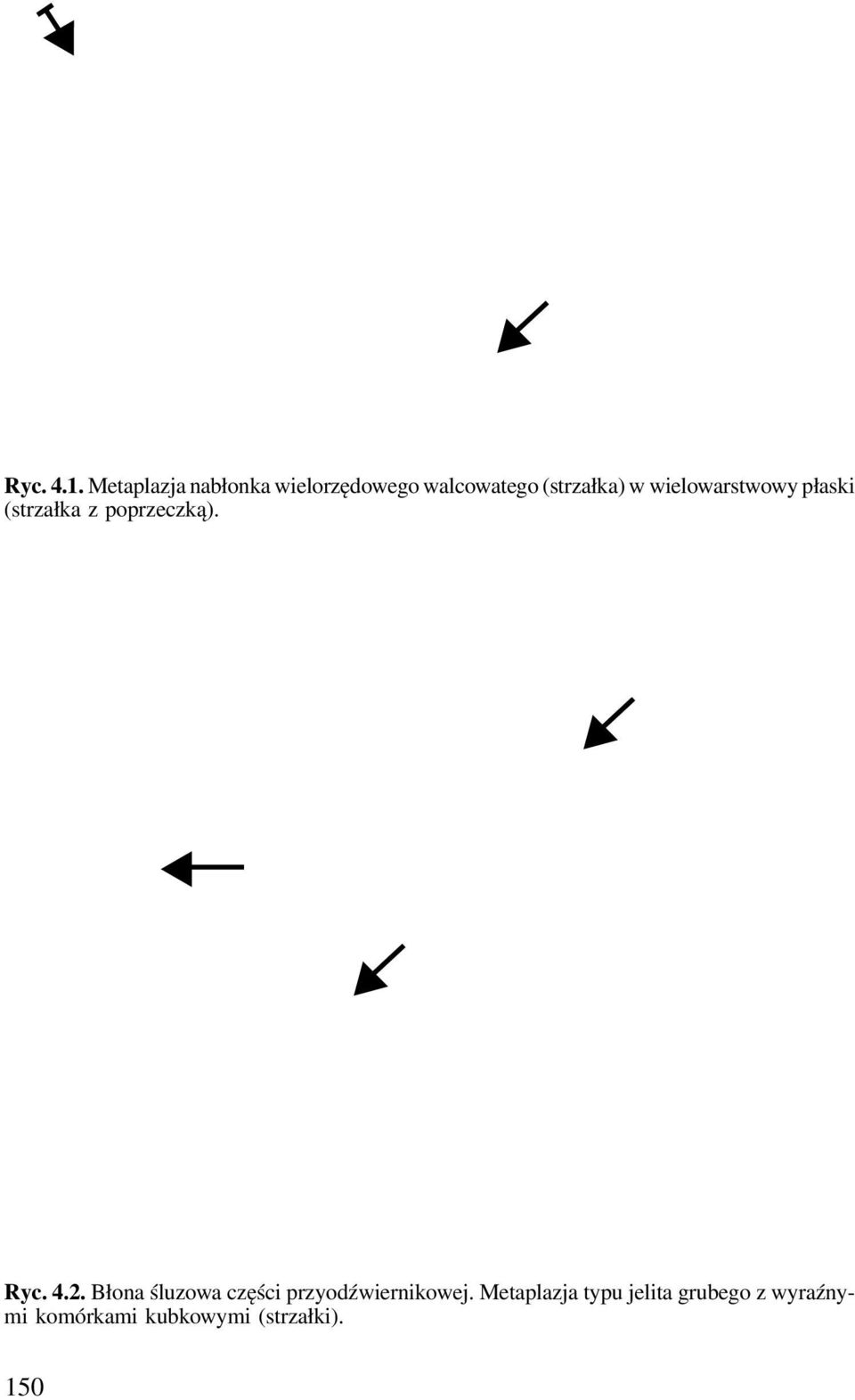 wielowarstwowy płaski (strzałka z poprzeczką). Ryc. 4.2.