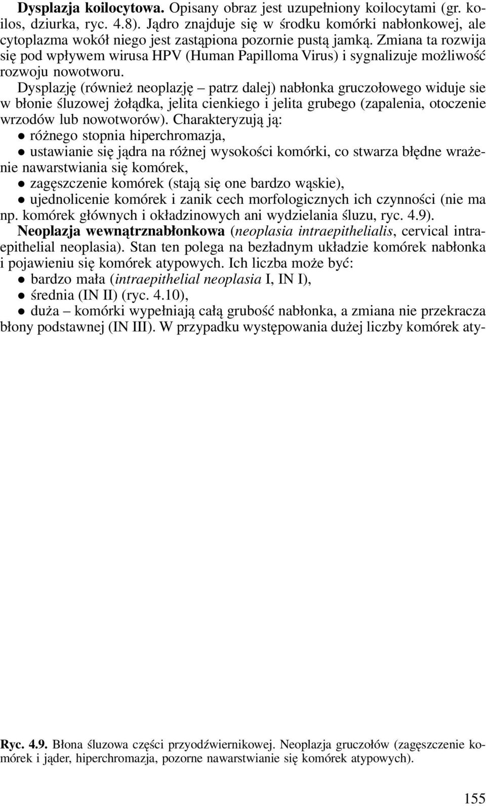 Zmiana ta rozwija się pod wpływem wirusa HPV (Human Papilloma Virus) i sygnalizuje możliwość rozwoju nowotworu.