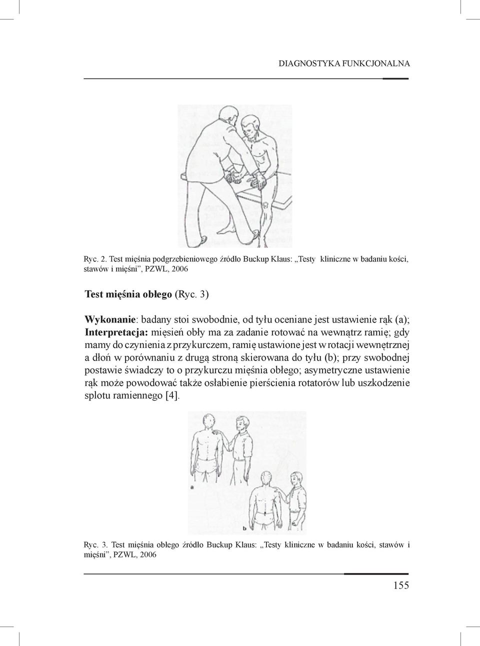 ramię ustawione jest w rotacji wewnętrznej a dłoń w porównaniu z drugą stroną skierowana do tyłu (b); przy swobodnej postawie świadczy to o przykurczu mięśnia obłego; asymetryczne