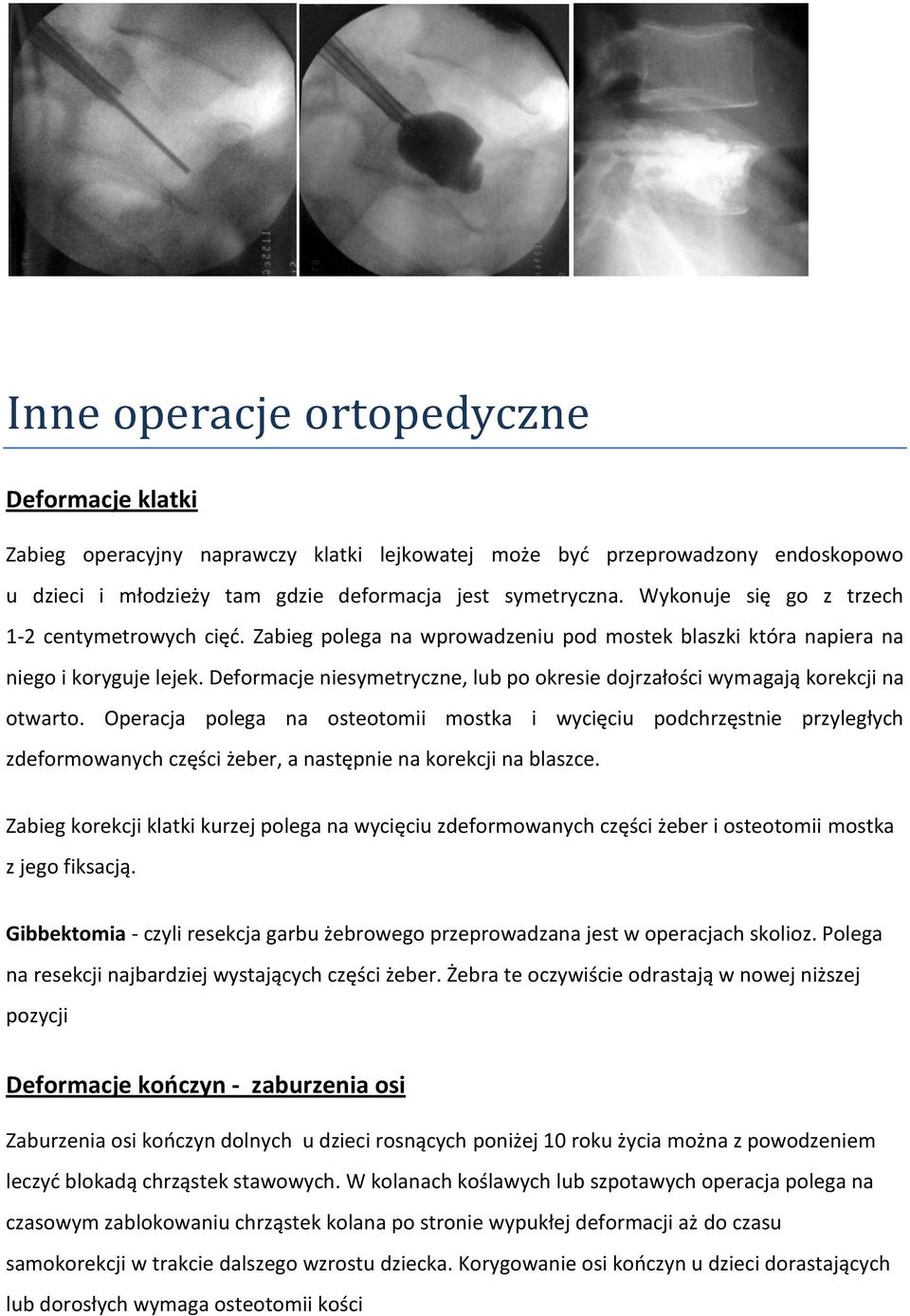 Deformacje niesymetryczne, lub po okresie dojrzałości wymagają korekcji na otwarto.