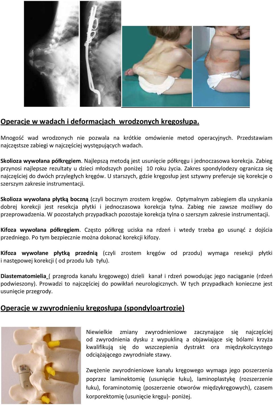 Zakres spondylodezy ogranicza się najczęściej do dwóch przyległych kręgów. U starszych, gdzie kręgosłup jest sztywny preferuje się korekcje o szerszym zakresie instrumentacji.