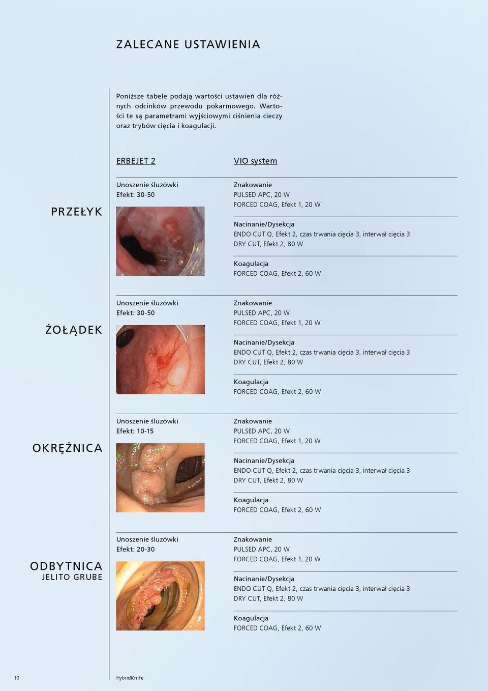 DRY CUT, Efekt 2, 80 W Koagulacja FORCED COAG, Efekt 2, 60 W ŻOŁ ĄDEK Unoszenie śluzówki Efekt: 30-50 Znakowanie PULSED APC, 20 W FORCED COAG, Efekt 1, 20 W Nacinanie/Dysekcja ENDO CUT Q, Efekt 2,