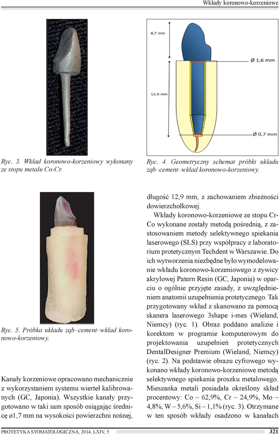 Wszystkie kanały przygotowano w taki sam sposób osiągając średnicę ø1,7 mm na wysokości powierzchni nośnej, długość 12,9 mm, z zachowaniem zbieżności dowierzchołkowej.