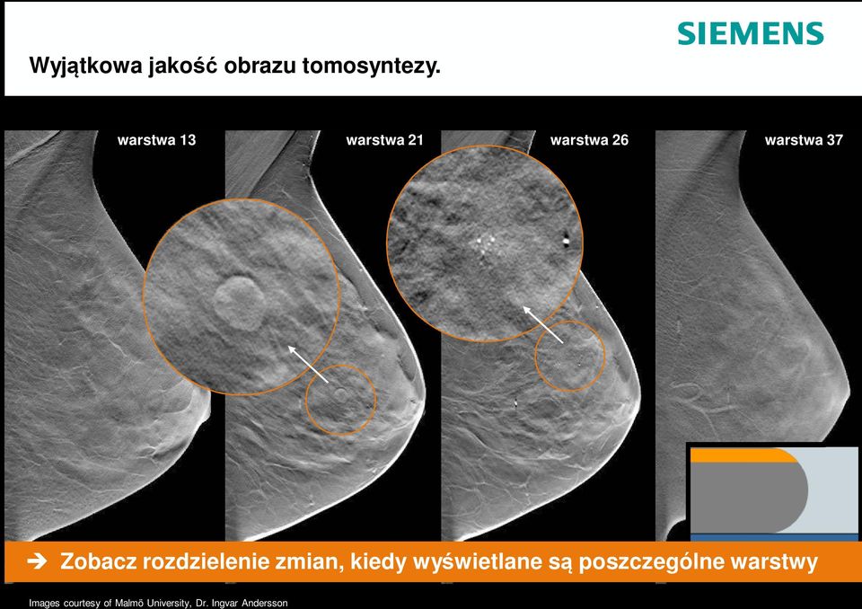 rozdzielenie zmian, kiedy wyświetlane są poszczególne