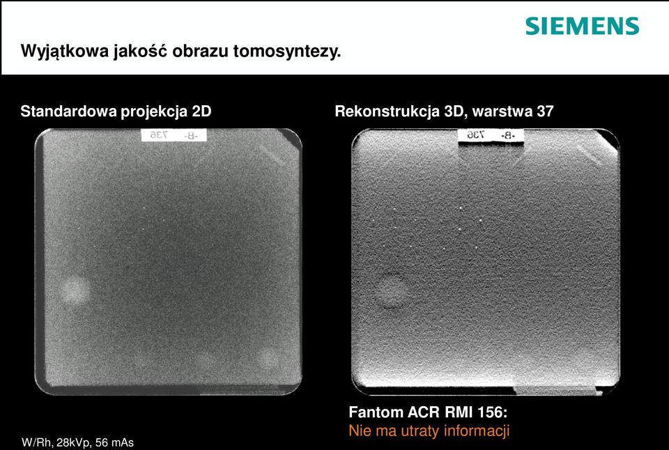3D, warstwa 37 W/Rh, 28kVp, 56 mas