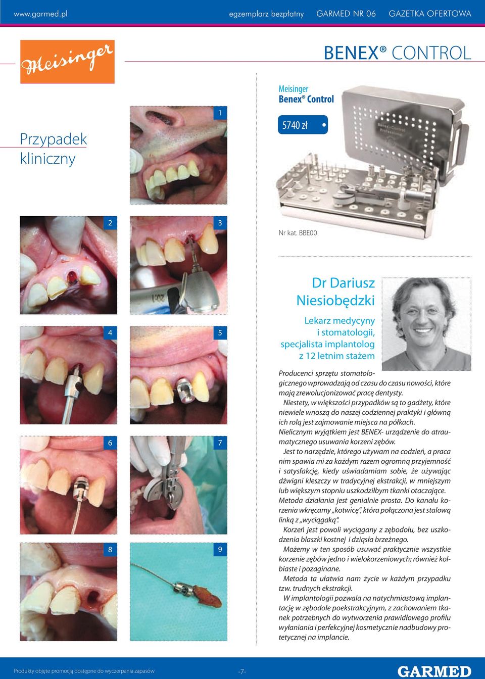 mają zrewolucjonizować pracę dentysty. Niestety, w większości przypadków są to gadżety, które niewiele wnoszą do naszej codziennej praktyki i główną ich rolą jest zajmowanie miejsca na półkach.