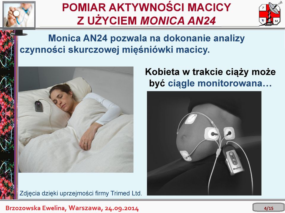 mięśniówki macicy.