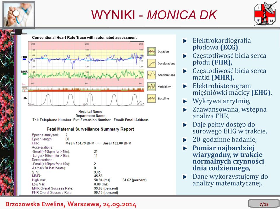 wstępna analiza FHR, Daje pełny dostęp do surowego EHG w trakcie, 20-godzinne badanie, Pomiar najbardziej