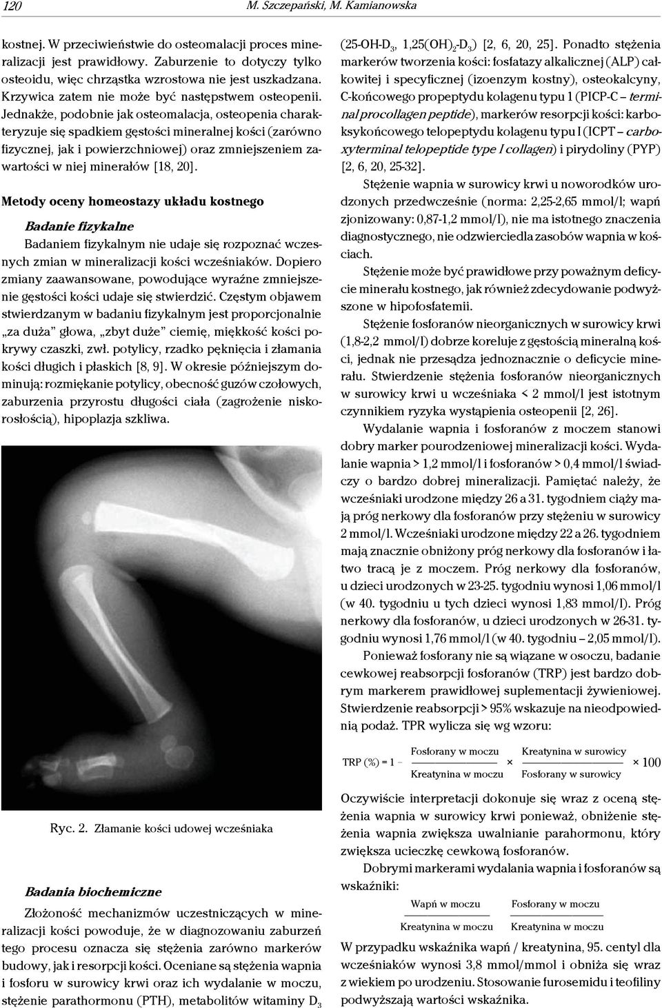 Jednakże, podobnie jak osteomalacja, osteopenia charakteryzuje się spadkiem gęstości mineralnej kości (zarówno fizycznej, jak i powierzchniowej) oraz zmniejszeniem zawartości w niej minerałów [18,