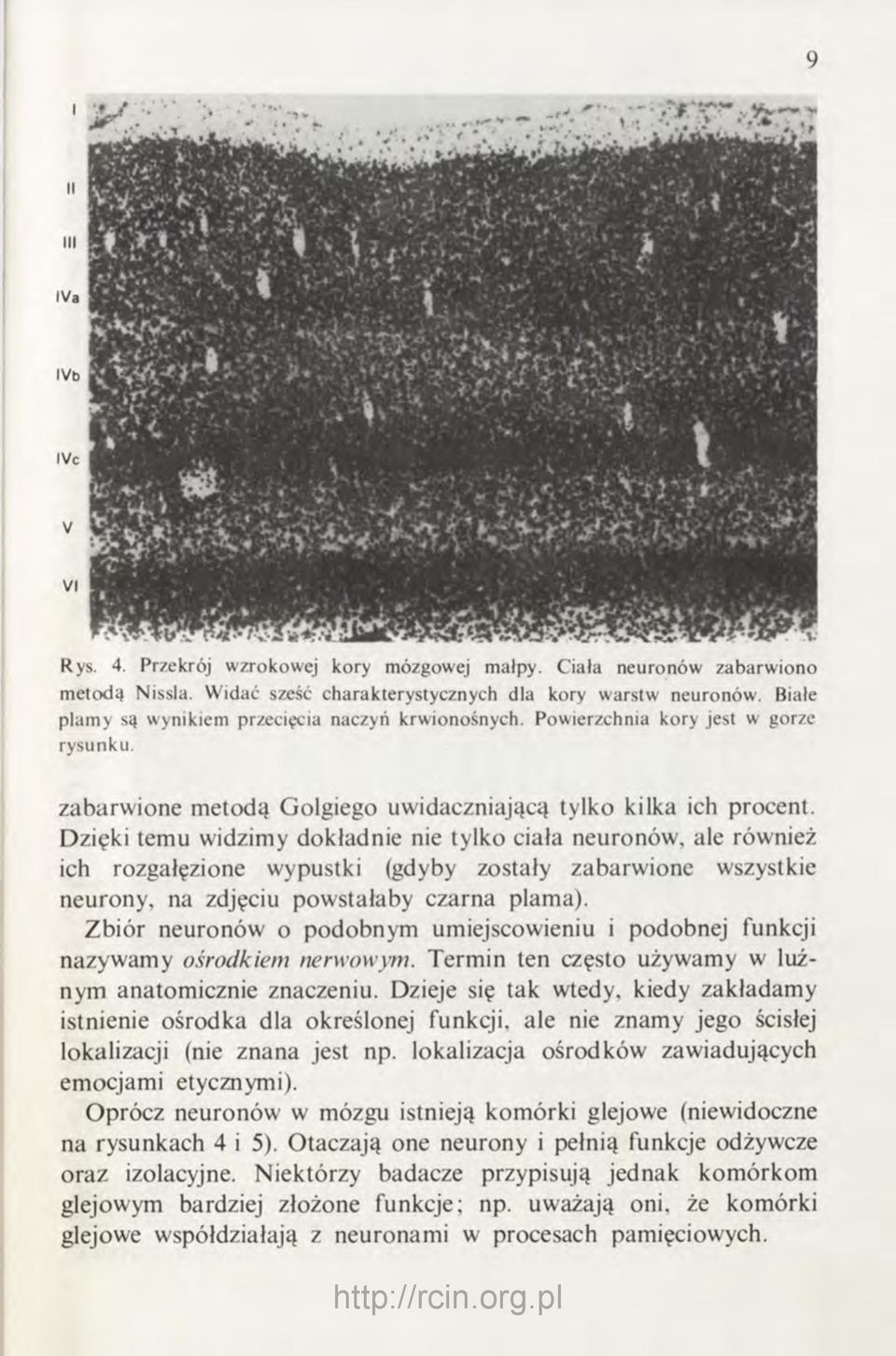 Dzięki temu widzimy dokładnie nie tylko ciała neuronów, ale również ich rozgałęzione wypustki (gdyby zostały zabarwione wszystkie neurony, na zdjęciu powstałaby czarna plama).