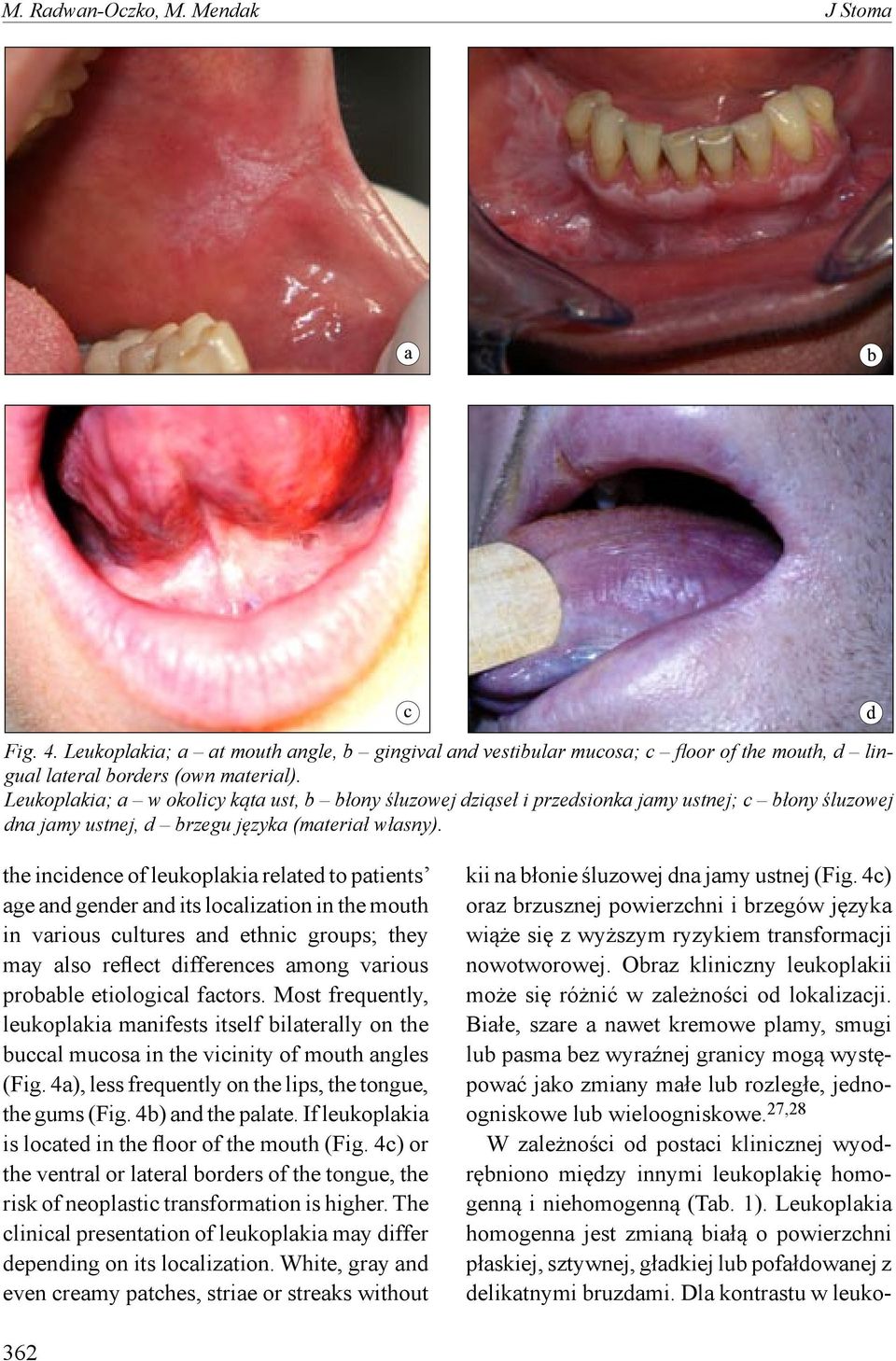 the incidence of leukoplakia related to patients age and gender and its localization in the mouth in various cultures and ethnic groups; they may also reflect differences among various probable