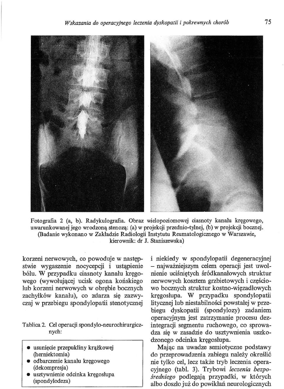 (Badanie wykonano w Zakładzie Radiologii Instytutu Reumatologicznego w Warszawie, kierownik: dr J. Staniszewska) korzeni nerwowych, co powoduje w następstwie wygaszenie nocycepcji i ustąpienie bólu.