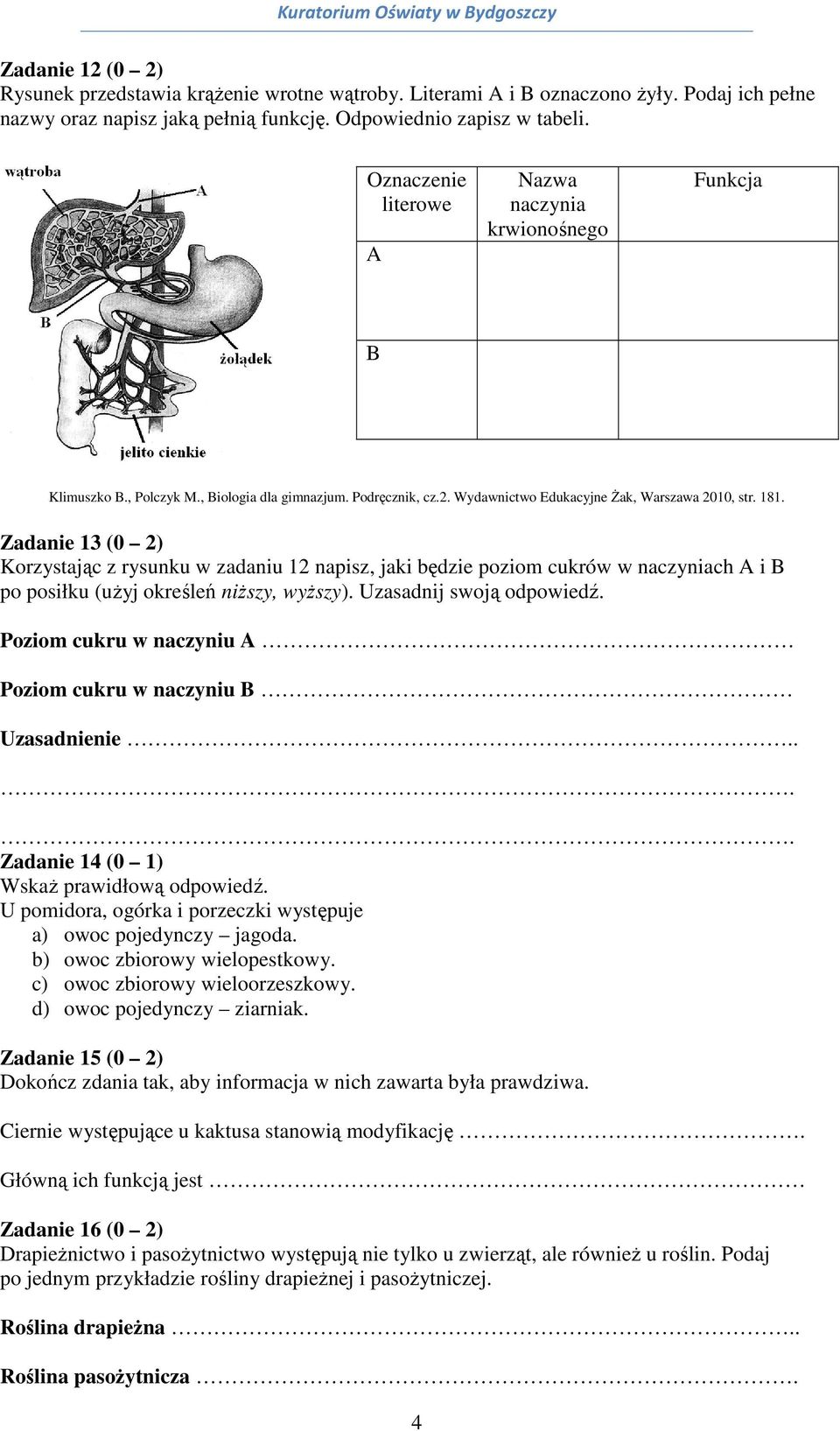 Zadanie 13 (0 2) Korzystając z rysunku w zadaniu 12 napisz, jaki będzie poziom cukrów w naczyniach A i B po posiłku (użyj określeń niższy, wyższy). Uzasadnij swoją odpowiedź.