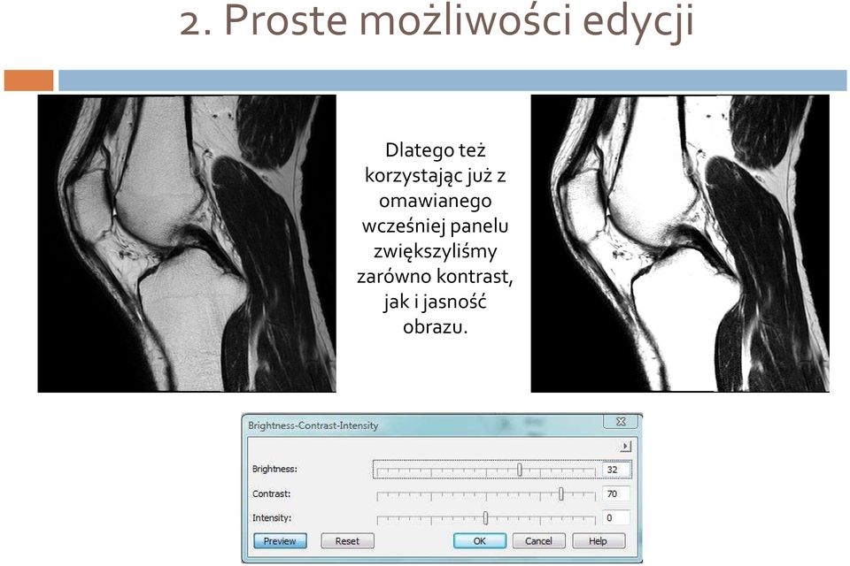 omawianego wcześniej panelu