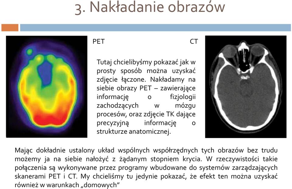 strukturze anatomicznej.