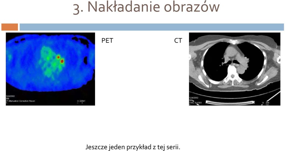 Jeszcze jeden