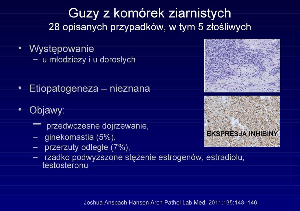 EKSPRESJA INHIBINY ginekomastia (5%), przerzuty odległe (7%), rzadko podwyższone