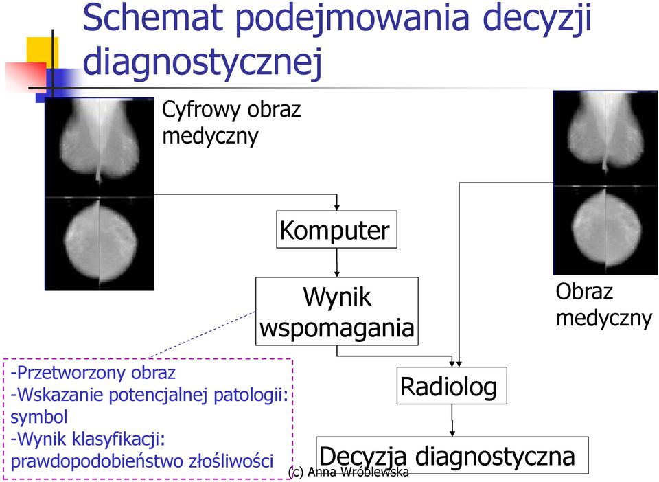 -Przetworzony obraz -Wskazanie potencjalnej patologii: symbol