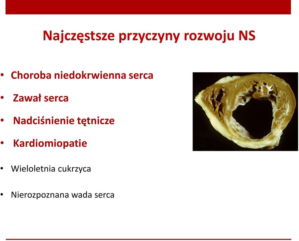 serca Nadciśnienie tętnicze