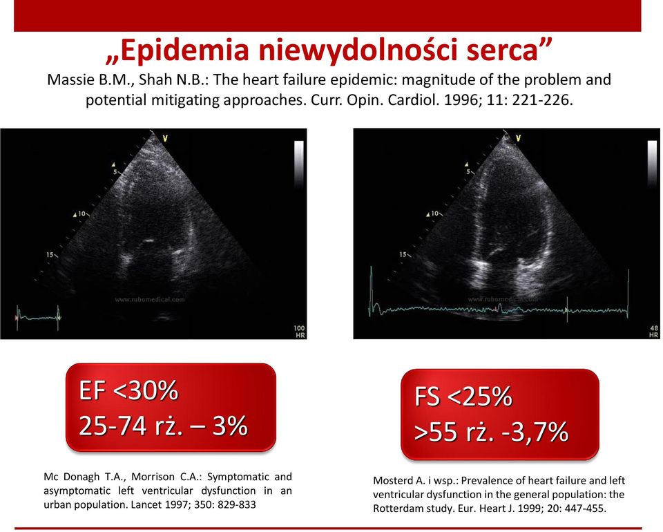 , Morrison C.A.: Symptomatic and asymptomatic left ventricular dysfunction in an urban population.