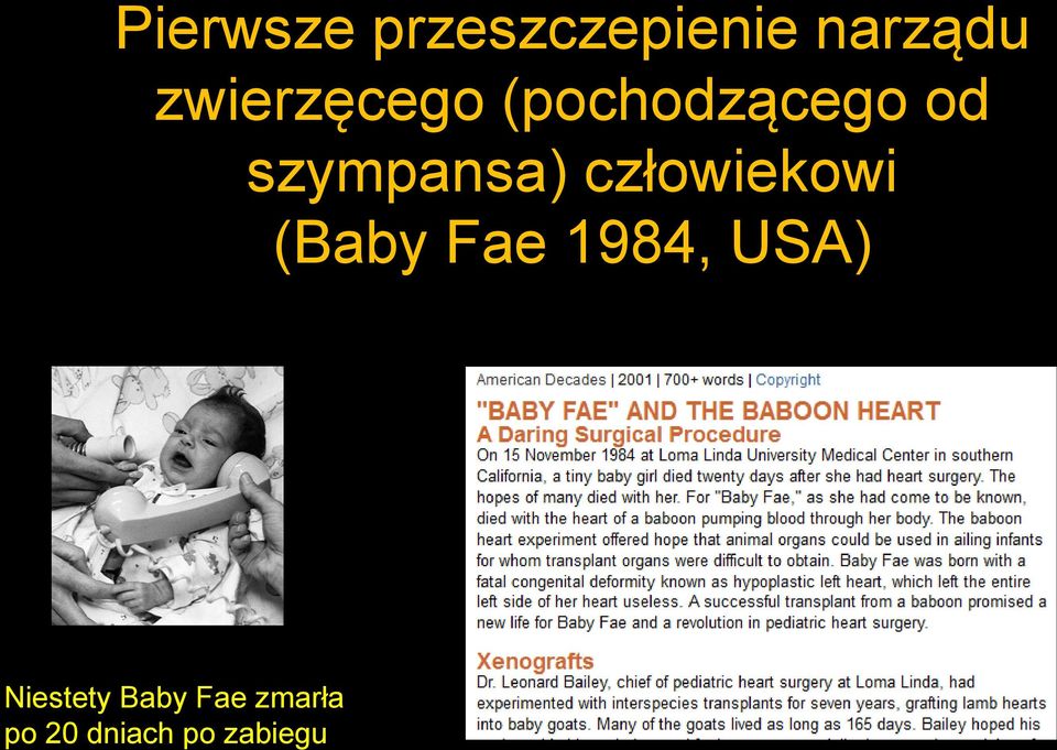 szympansa) człowiekowi (Baby Fae 1984,