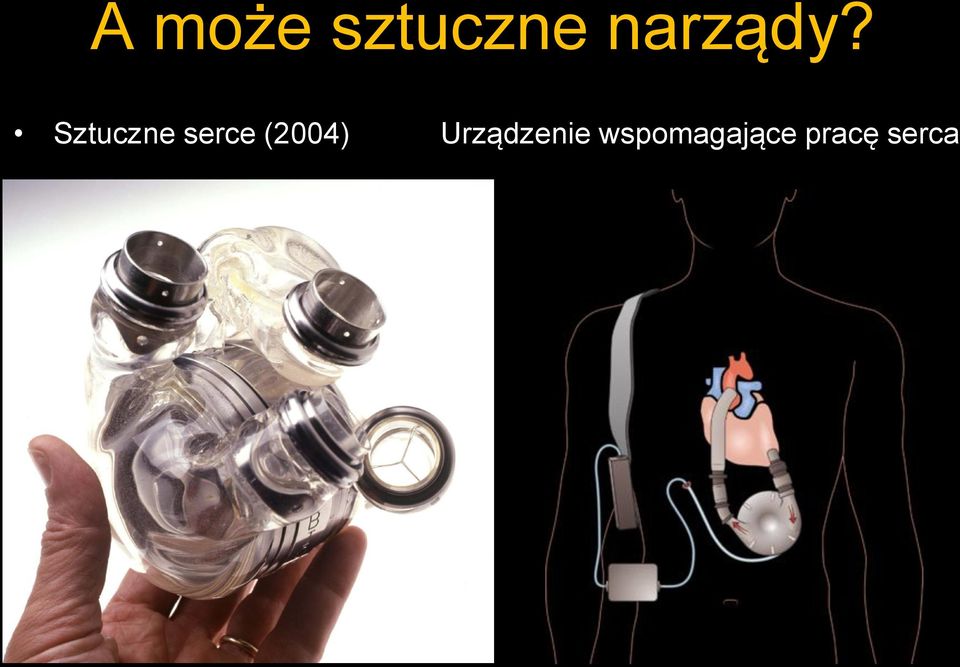 Sztuczne serce