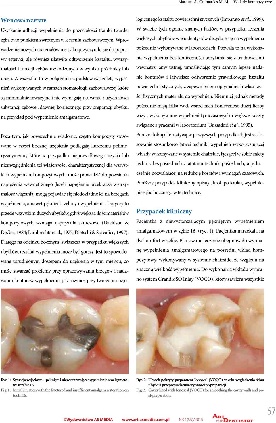 A wszystko to w połączeniu z podstawową zaletą wypełnień wykonywanych w ramach stomatologii zachowawczej, które są minimalnie inwazyjne i nie wymagają usuwania dużych ilości substancji zębowej,