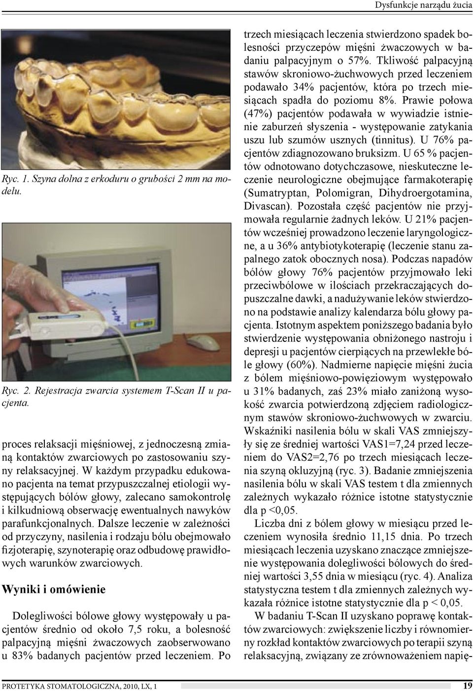 W każdym przypadku edukowano pacjenta na temat przypuszczalnej etiologii występujących bólów głowy, zalecano samokontrolę i kilkudniową obserwację ewentualnych nawyków parafunkcjonalnych.