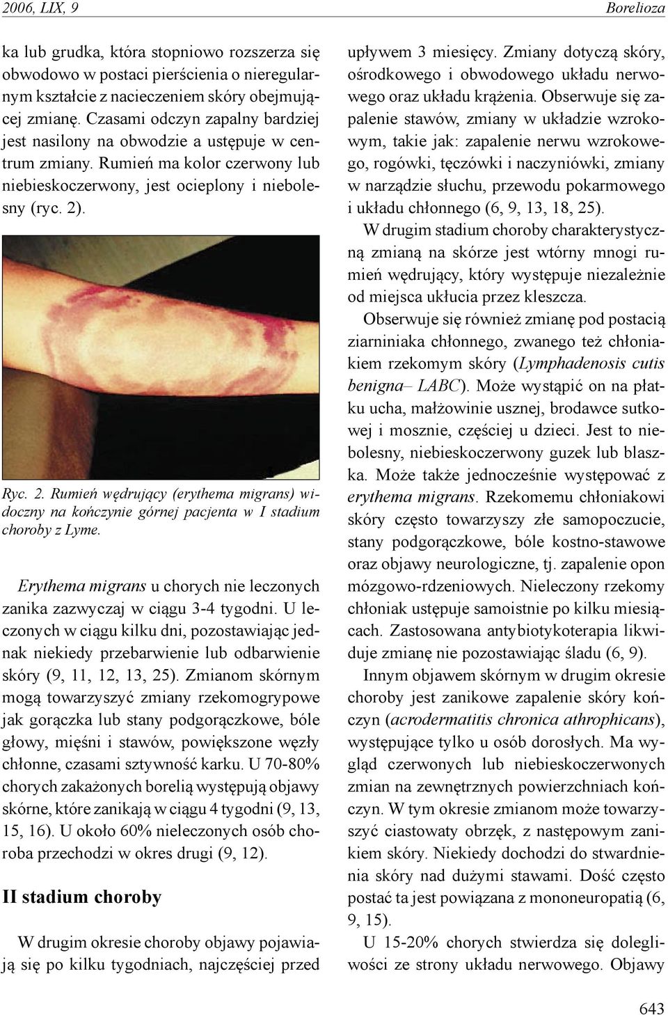 . Ryc. 2. Rumień wędrujący (erythema migrans) widoczny na kończynie górnej pacjenta w I stadium choroby z Lyme. Erythema migrans u chorych nie leczonych zanika zazwyczaj w ciągu 3-4 tygodni.