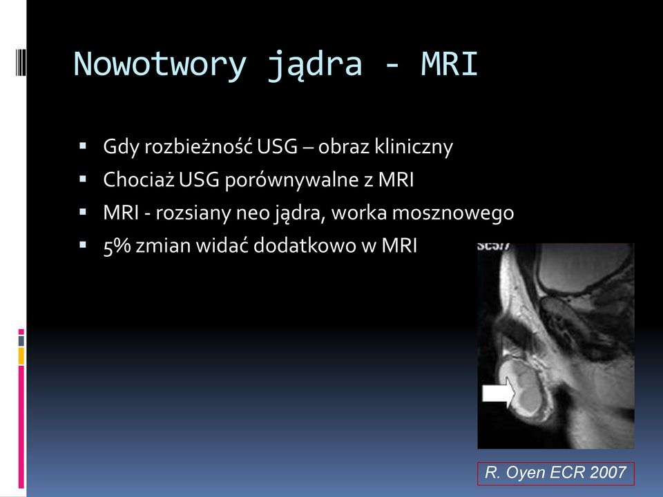 MRI MRI - rozsiany neo jądra, worka