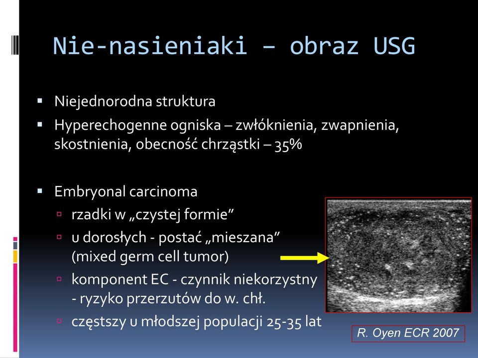 formie u dorosłych - postać mieszana (mixed germ cell tumor) komponent EC - czynnik