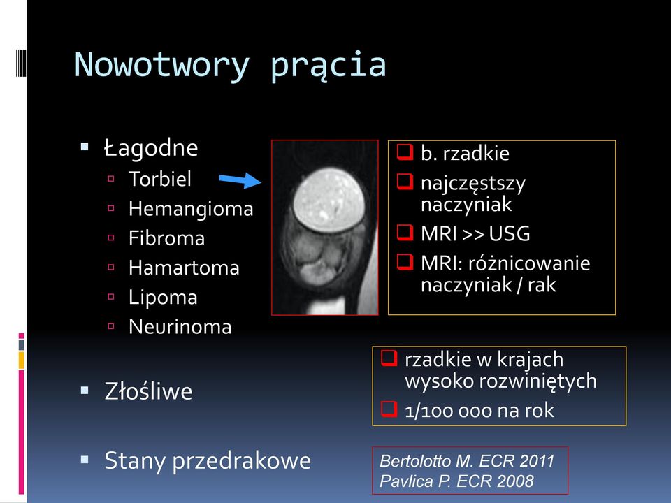 rzadkie najczęstszy naczyniak MRI >> USG MRI: różnicowanie naczyniak /