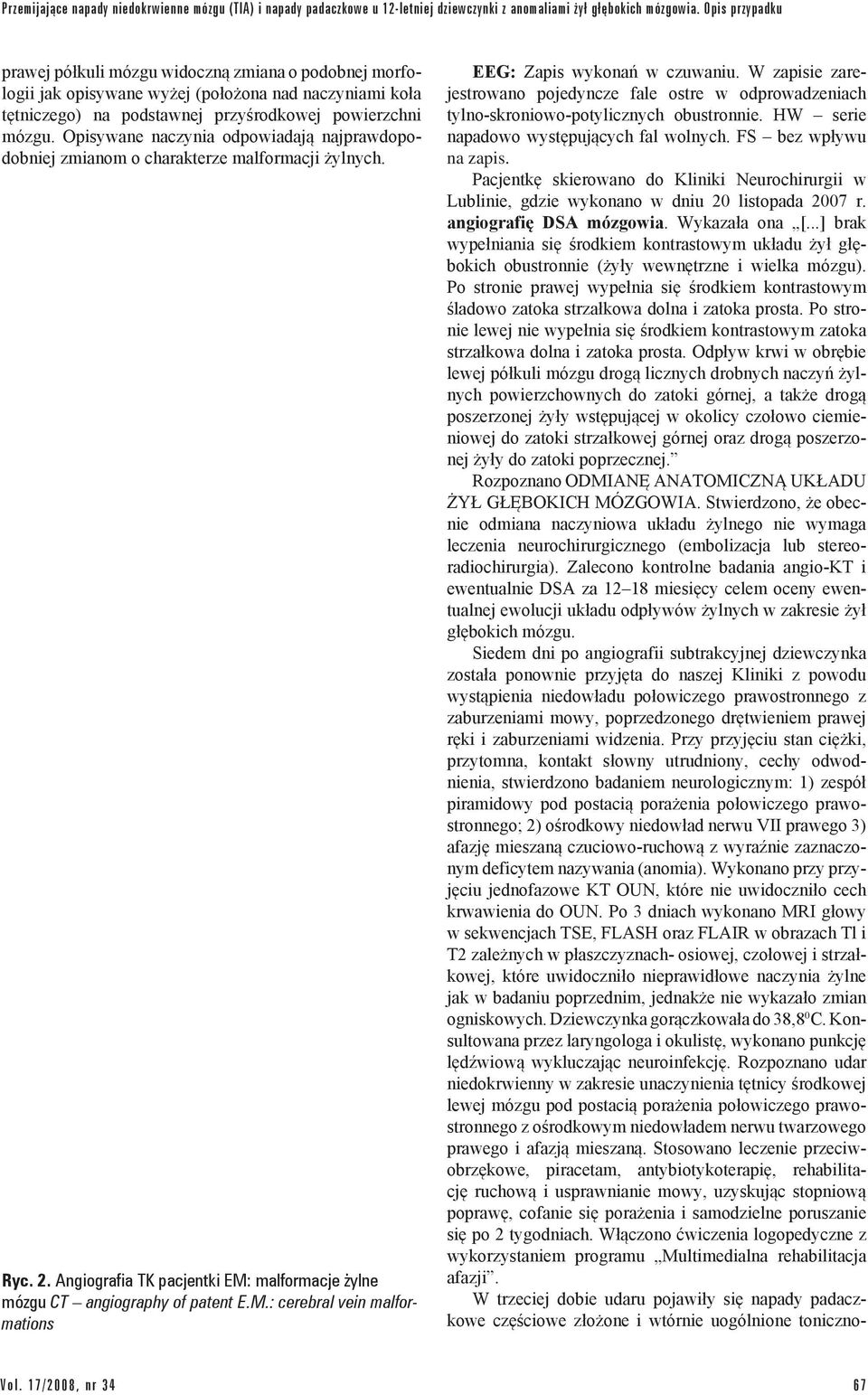 Opisywane naczynia odpowiadają najprawdopodobniej zmianom o charakterze malformacji żylnych. Ryc. 2. Angiografia TK pacjentki EM: malformacje żylne mózgu CT angiography of patent E.M.: cerebral vein malformations EEG: Zapis wykonań w czuwaniu.