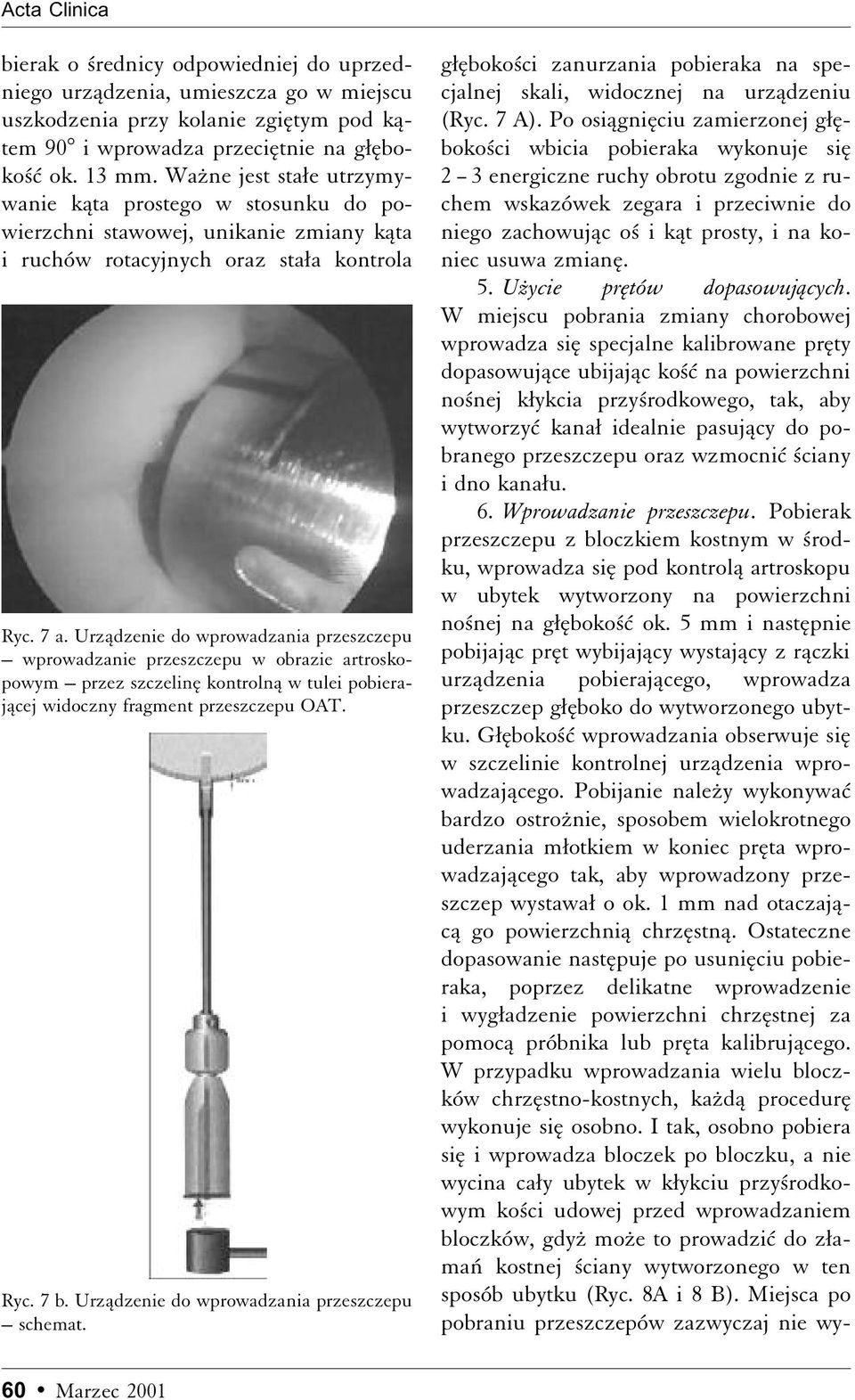 Urzådzenie do wprowadzania przeszczepu wprowadzanie przeszczepu w obrazie artroskopowym przez szczelinæ kontrolnå w tulei pobierajåcej widoczny fragment przeszczepu OAT. Ryc. 7 b.