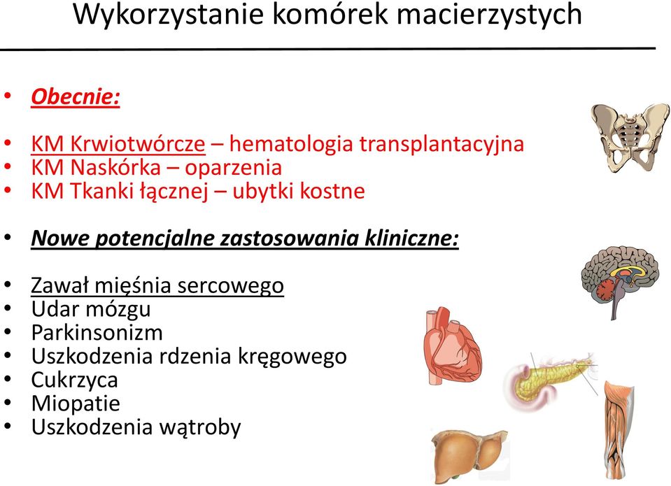 Nowe potencjalne zastosowania kliniczne: Zawał mięśnia sercowego Udar